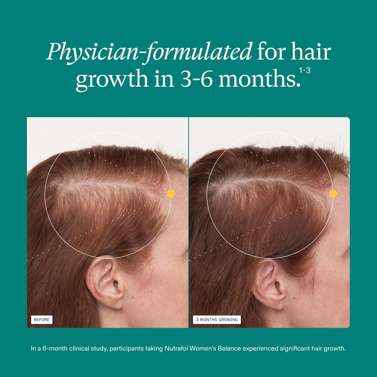 1759515179_Nutrafol-Womens-Balance-Hair-Growth-Supplements-Ages-45-and-Up-Clinically-Proven-for-Visibly-Thicker-Hair-and-Scalp-Coverage-Dermatologist-Recommended-1-Month-Supply.jpg Nutrafol Women's Balance Hair Growth Supplements, Ages 45 and Up, Clinically Proven for Visibly Thicker Hair and Scalp Coverage, Dermatologist Recommended - 1 Month Supply - Image 5