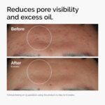 The Ordinary Niacinamide 10% + Zinc 1%, Smoothing Serum for Blemish-Prone Skin - Image 3