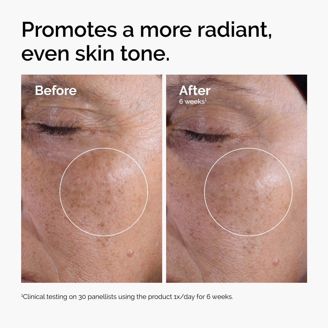 1760046435_The-Ordinary-Glycolic-Acid-7-Exfoliating-Toner-Brightening-and-Smoothing-Daily-Toner-for-More-Even-Looking-Skin-Tone.jpg The Ordinary Glycolic Acid 7% Exfoliating Toner, Brightening and Smoothing Daily Toner for More Even-Looking Skin Tone - Image 3