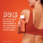 Bio-Oil Skincare Body Oil Serum, Face and Body Moisturizer with Vitamin E & A, for Scars, Stretch Marks, Sensitive Skin, All Skin Types, Dermatologist Recommended, Non-Comedogenic, 6.7 Oz - Image 4
