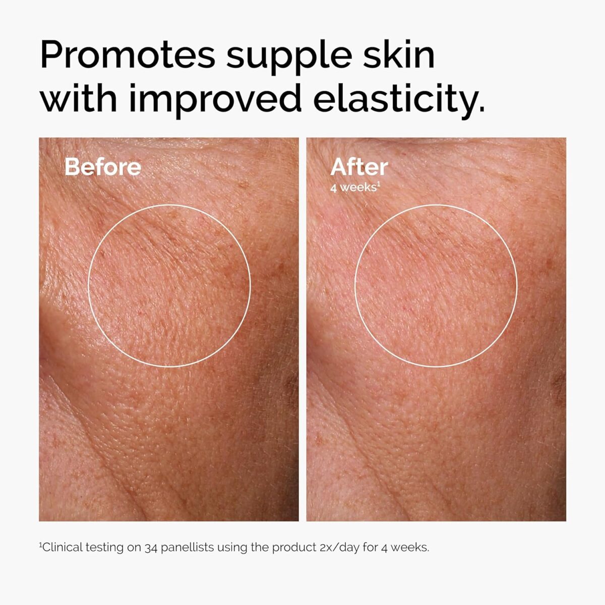 The Ordinary Hyaluronic Acid 2% + B5 (with Ceramides), Multi-Depth Hydration Serum for Plumper, Smoother Skin - Image 3