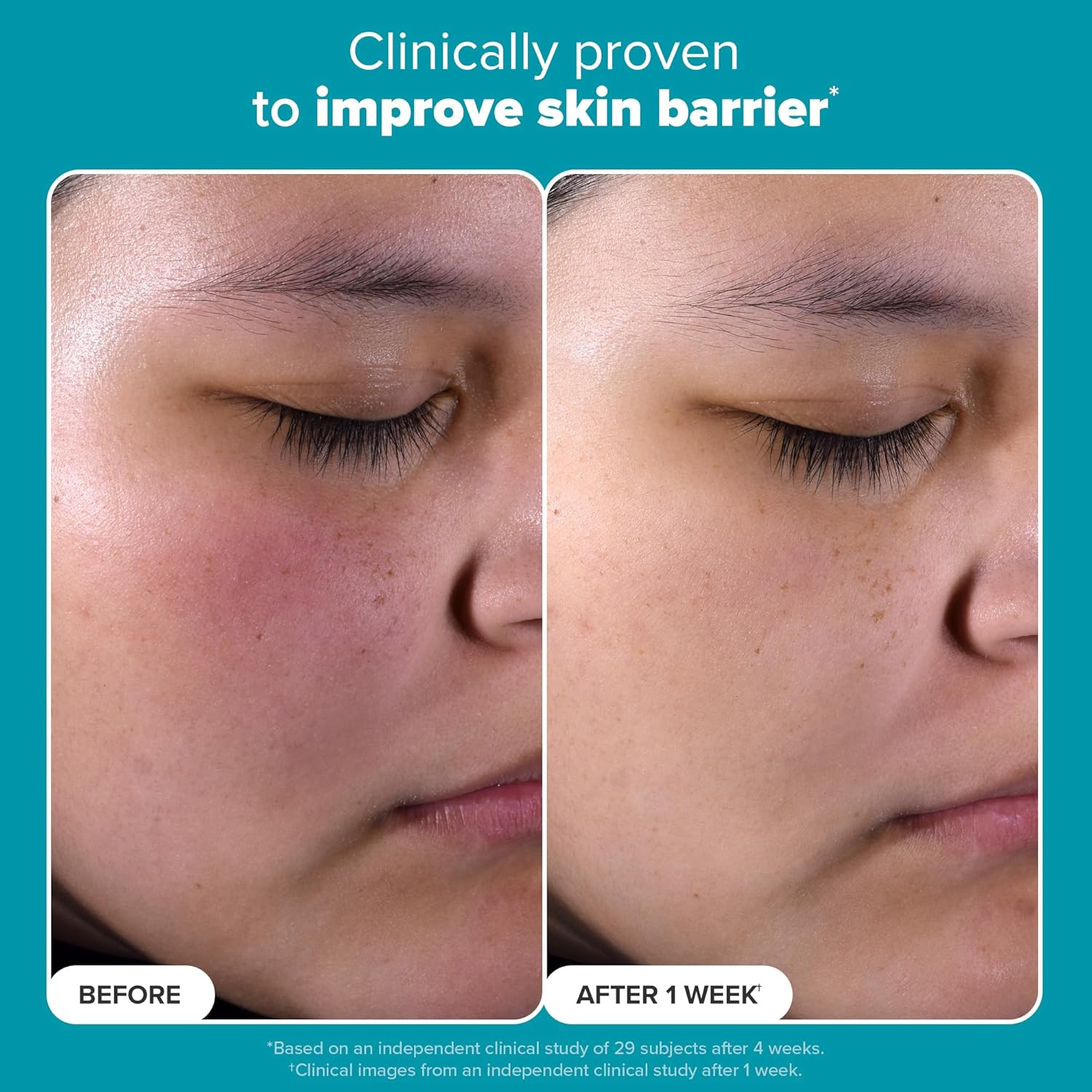 1761206797_Paulas-Choice-SKIN-PERFECTING-2-BHA-Liquid-Exfoliant-with-Salicylic-Acid-Facial-Polish-for-Enlarged-Pores-Wrinkles-Fine-Lines-Suitable-for-Blackhead-Prone-Skin-Fragrance-Free.jpg Paula's Choice SKIN PERFECTING 2% BHA Liquid Exfoliant with Salicylic Acid, Facial Polish for Enlarged Pores, Wrinkles & Fine Lines, Suitable for Blackhead-Prone Skin, Fragrance-Free - Image 6