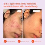 Tower 28 SOS Daily Rescue Facial Spray - Hypochlorous Acid Spray to Help Reduce Redness, Calm Irritation + Alleviate Flare-Ups - Purifying Travel Size Face Toner - Everyday Skin Care Essential (1 oz) - Image 5