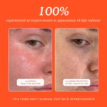 Tower 28 SOS Daily Rescue Facial Spray - Hypochlorous Acid Spray to Help Reduce Redness, Calm Irritation + Alleviate Flare-Ups - Purifying Travel Size Face Toner - Everyday Skin Care Essential (1 oz) - Image 7