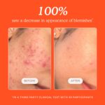 Tower 28 SOS Daily Rescue Facial Spray - Hypochlorous Acid Spray to Help Reduce Redness, Calm Irritation + Alleviate Flare-Ups - Purifying Travel Size Face Toner - Everyday Skin Care Essential (1 oz) - Image 8