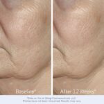 Obagi ELASTIderm Facial Serum – Firming Face Serum with Patented Bi-Mineral Contour Complex Clinically Proven to Target Signs Of Skin Aging - Image 6