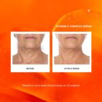 Naturium Vitamin C Complex Face Serum, Anti-Aging Facial Treatment with Hyaluronic Acid & Vitamin E, 1 oz - Image 4