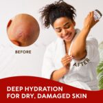 Beef Tallow for Skin - Whipped Tallow and Honey Balm - Grass Fed Beef Tallow for Face, Daily Moisturizer & Body Butter - Natural Non Comedogenic Skincare (4.3 oz) - Image 7